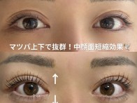 Before 2